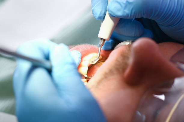 Best Cosmetic Emergency Dentistry in Wapello, IA