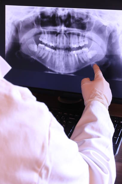 Best Emergency Gum Treatment in Wapello, IA