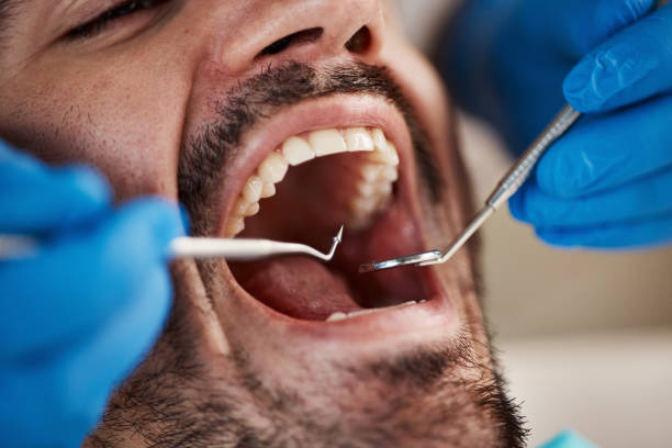 Best Emergency Treatment for Dental Infections or Abscesses in Wapello, IA