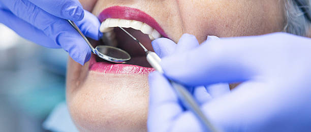 Best Emergency Wisdom Teeth Removal in Wapello, IA
